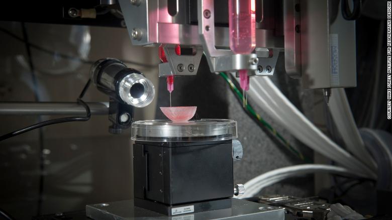 我们什么时候可以 3D 打印器官，谁买得起